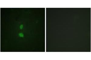 Immunofluorescence analysis of HuvEc cells, using SNAI1 (Phospho-Ser246) Antibody. (SNAIL Antikörper  (pSer246))