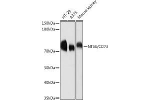 Western blot analysis of extracts of various cell lines, using CD73/NT5E antibody (ABIN3022733, ABIN3022734, ABIN3022735, ABIN1513283 and ABIN6219201) at 1:1000 dilution. (CD73 Antikörper  (AA 290-550))