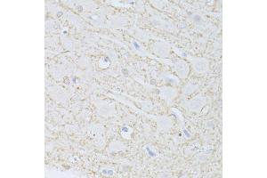 Immunohistochemistry of paraffin-embedded rat brain using PHGDH antibody (ABIN5998506) at dilution of 1/100 (40x lens). (PHGDH Antikörper)