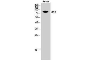 Western Blotting (WB) image for anti-Ezrin (EZR) (Tyr315) antibody (ABIN3175040) (Ezrin Antikörper  (Tyr315))