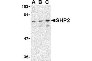 Image no. 1 for anti-Protein tyrosine Phosphatase, Non-Receptor Type 11 (PTPN11) (C-Term) antibody (ABIN318781) (PTPN11 Antikörper  (C-Term))