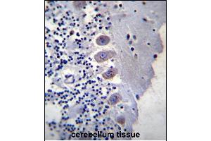 Immunohistochemistry (Paraffin-embedded Sections) (IHC (p)) image for anti-Brain Expressed, Associated with NEDD4, 1 (BEAN1) (AA 45-73), (N-Term) antibody (ABIN657309)