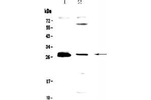 Western blot analysis of TWEAK using anti-TWEAK antibody . (TWEAK Antikörper  (AA 94-249))