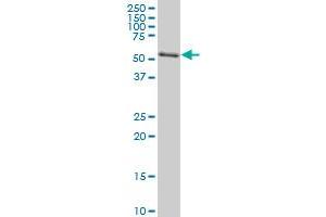 AKT2 monoclonal antibody (M06), clone X1 Western Blot analysis of AKT2 expression in Jurkat .