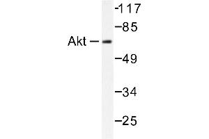 Image no. 1 for anti-V-Akt Murine Thymoma Viral Oncogene Homolog 1 (AKT1) antibody (ABIN265302) (AKT1 Antikörper)