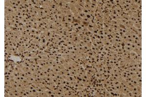 ABIN6272294 at 1/100 staining Mouse liver tissue by IHC-P. (EPS8-Like 3 Antikörper)