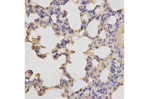 Immunohistochemistry of paraffin-embedded mouse lung using PRKACB antibody (ABIN5973065) at dilution of 1/200 (40x lens). (PRKACB Antikörper)