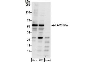 Western Blotting (WB) image for anti-LAP2 beta gamma/tmpo (AA 350-400) antibody (ABIN7455057) (LAP2 beta gamma/tmpo (AA 350-400) Antikörper)
