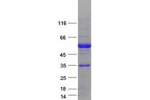 Western Blotting (WB) image for Estrogen-Related Receptor alpha (ESRRA) protein (Myc-DYKDDDDK Tag) (ABIN2720550)