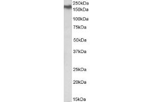 Western Blotting (WB) image for anti-Niemann-Pick Disease, Type C1 (NPC1) (Internal Region) antibody (ABIN1590132)