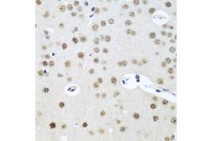 Immunohistochemistry of paraffin-embedded mouse brain using UTP14A antibody (ABIN5974631) at dilution of 1/100 (40x lens). (UTP14A Antikörper)