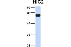 Host:  Rabbit  Target Name:  HIC2  Sample Type:  Human Fetal Brain  Antibody Dilution:  1. (HIC2 Antikörper  (Middle Region))