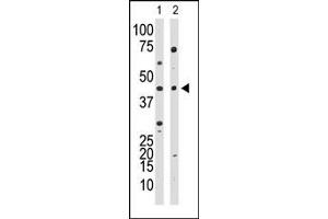 Western Blotting (WB) image for anti-YY1 Transcription Factor (YY1) (Middle Region) antibody (ABIN357757) (YY1 Antikörper  (Middle Region))