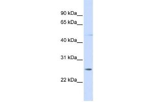 Western Blotting (WB) image for anti-Ring Finger Protein 170 (RNF170) antibody (ABIN2458739) (RNF170 Antikörper)