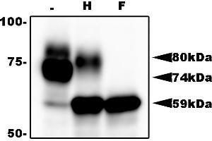Western Blotting (WB) image for anti-HHV6 gQ1 (AA 3-422) antibody (ABIN2452012) (HHV6 gQ1 (AA 3-422) Antikörper)