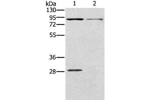 Western Blot analysis of Mouse kidney and brain tissue using CNGA3 Polyclonal Antibody at dilution of 1:500 (CNGA3 Antikörper)