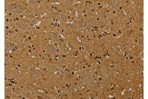 ABIN6269010 at 1/100 staining Rat brain tissue by IHC-P. (HSPA9 Antikörper  (C-Term))