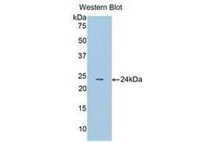 Western Blotting (WB) image for anti-Cathepsin B (CTSB) (AA 129-333) antibody (ABIN1858541)
