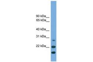 Image no. 1 for anti-ASF1 Anti-Silencing Function 1 Homolog A (S. Cerevisiae) (ASF1A) (N-Term) antibody (ABIN6745605)
