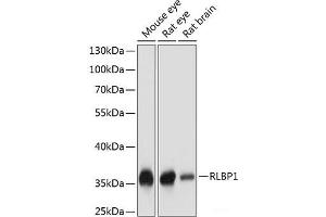 Western blot analysis of extracts of various cell lines using RLBP1 Polyclonal Antibody at dilution of 1:1000.