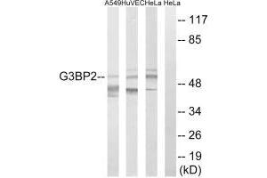 Western blot analysis of extracts from A549 cells, HUVEC cells and HeLa cells, using G3BP2 antibody. (G3BP2 Antikörper  (C-Term))