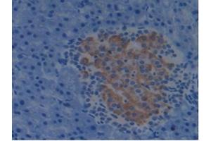 Immunohistochemistry (IHC) image for anti-Programmed Cell Death 6 Interacting Protein (PDCD6IP) (AA 1-239) antibody (ABIN7444118)