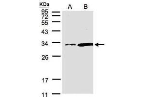 WB Image Sample(30 μg of whole cell lysate) A:Hep G2, B:MOLT4, 12% SDS PAGE antibody diluted at 1:1500