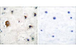 Peptide - +Immunohistochemical analysis of paraffin-embedded human brain tissue using Connexin 43 antibody. (Connexin 43/GJA1 Antikörper)