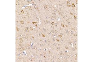 Immunohistochemistry of paraffin-embedded mouse brain using [KO Validated] TR Rabbit pAb (ABIN3021164, ABIN3021165, ABIN3021166 and ABIN1513640) at dilution of 1:250 (40x lens). (TRAF2 Antikörper  (AA 1-300))