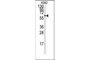 Image no. 1 for anti-Cytochrome P450, Family 17, Subfamily A, Polypeptide 1 (CYP17A1) (Middle Region) antibody (ABIN360245) (CYP17A1 Antikörper  (Middle Region))