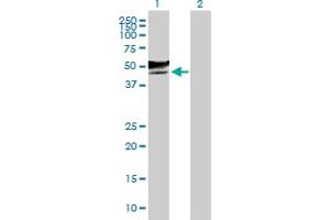 Western Blotting (WB) image for anti-Glucosaminyl (N-Acetyl) Transferase 2, I-Branching Enzyme (I Blood Group) (GCNT2) (AA 1-402) antibody (ABIN515998)