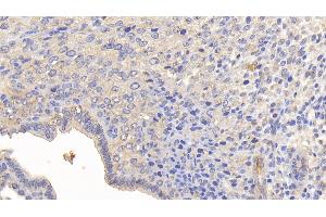 Detection of MMP13 in Mouse Uterus Tissue using Polyclonal Antibody to Matrix Metalloproteinase 13 (MMP13) (MMP13 Antikörper  (AA 66-238))