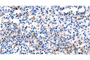 Immunohistochemistry of paraffin-embedded Human tonsil tissue using GADD45 gamma Polyclonal Antibody at dilution 1:120 (GADD45G Antikörper)