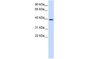 MOGAT2 antibody used at 1 ug/ml to detect target protein.