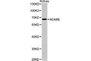 Western blot analysis of extracts of Kidney cells, using NUMBL antibody (ABIN5971167). (NUMBL Antikörper)