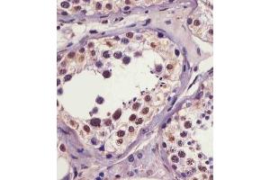(ABIN6241064 and ABIN6578961) staining IRAK1 in human testis tissue sections by Immunohistochemistry (IHC-P - paraformaldehyde-fixed, paraffin-embedded sections). (IRAK1 Antikörper  (pSer376))