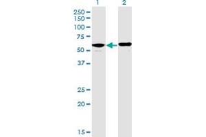 Western Blotting (WB) image for anti-Protein Phosphatase 2, Regulatory Subunit B', delta (PPP2R5D) (AA 1-602) antibody (ABIN519129)