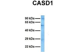 Host:  Rabbit  Target Name:  CASD1  Sample Tissue:  Human HT1080  Antibody Dilution:  1. (CASD1 Antikörper  (N-Term))