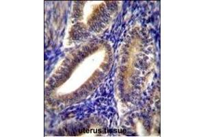 CNN2 Antibody (N-term) (ABIN656350 and ABIN2845649) immunohistochemistry analysis in formalin fixed and paraffin embedded human uterus tissue followed by peroxidase conjugation of the secondary antibody and DAB staining. (CNN2 Antikörper  (N-Term))