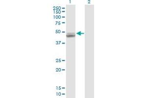 Western Blotting (WB) image for anti-Ubiquinol-Cytochrome C Reductase Core Protein I (UQCRC1) (AA 1-480) antibody (ABIN521270)