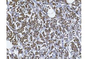 IHC analysis of BAF57/SMARCE1 using anti-BAF57/SMARCE1 antibody (ABIN7600326).