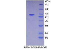 SDS-PAGE analysis of Human Checkpoint Homolog 2 Protein. (CHEK2 Protein)