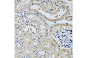 Immunohistochemistry of paraffin-embedded mouse kidney using CHMP1B antibody (ABIN5974811) at dilution of 1/100 (40x lens).