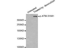 Western blot analysis of extracts of 293 cells, using phospho-ATM-S1981 antibody. (ATM Antikörper  (pSer1981))