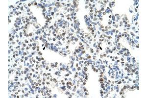 WDR6 antibody was used for immunohistochemistry at a concentration of 4-8 ug/ml to stain Alveolar cells (arrows) in Human Lung.