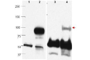 Image no. 1 for anti-PR Domain Containing 1, with ZNF Domain (PRDM1) (C-Term) antibody (ABIN401477) (PRDM1 Antikörper  (C-Term))