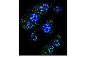 Confocal immunofluorescent analysis of MGMT Antibody (N-term) (ABIN657769 and ABIN2846745) with MCF-7 cell followed by Alexa Fluor 488-conjugated goat anti-rabbit lgG (green). (MGMT Antikörper  (N-Term))