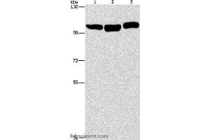 Western blot analysis of Hela, NIH/3T3 and Raji cell, using DNM2 Polyclonal Antibody at dilution of 1:400 (DNM2 Antikörper)