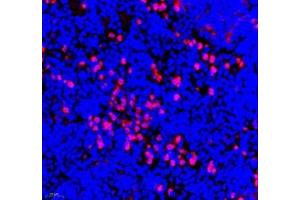 Immunofluorescence of paraffin embedded mouse spleen using ANXA3 (ABIN7073065) at dilution of 1: 300 (400x lens) (Annexin A3 Antikörper)