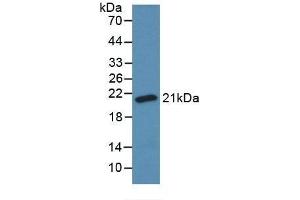 Detection of Recombinant SOD1, Bovine using Monoclonal Antibody to Superoxide Dismutase 1 (SOD1) (SOD1 Antikörper  (AA 2-152))